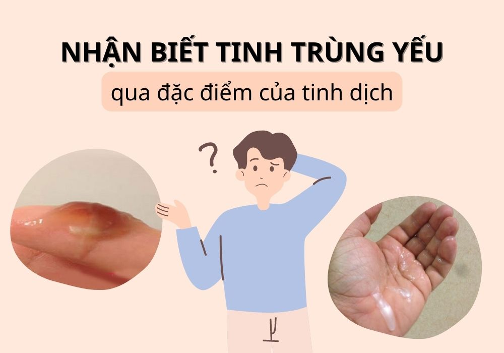 TINH TRÙNG YẾU - NGUYÊN NHÂN LÀ GÌ?
